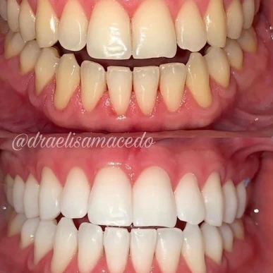 resultados (5) - fix